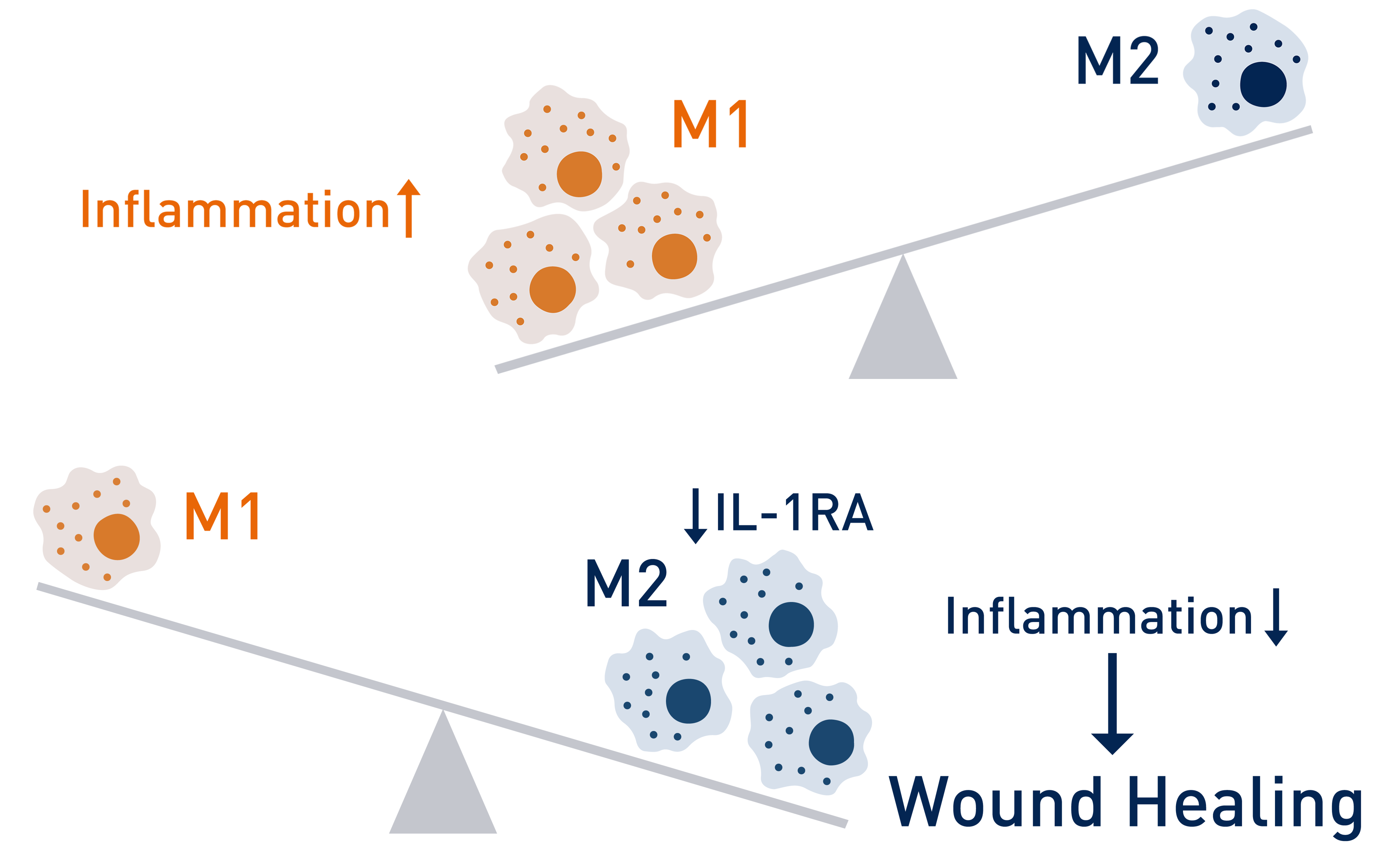Drawing of the ratio of M1 and M2 macrophages with the help of a scale. In the stage of inflammation M1 macrophages predominate, in wound healing M2 macrophages.