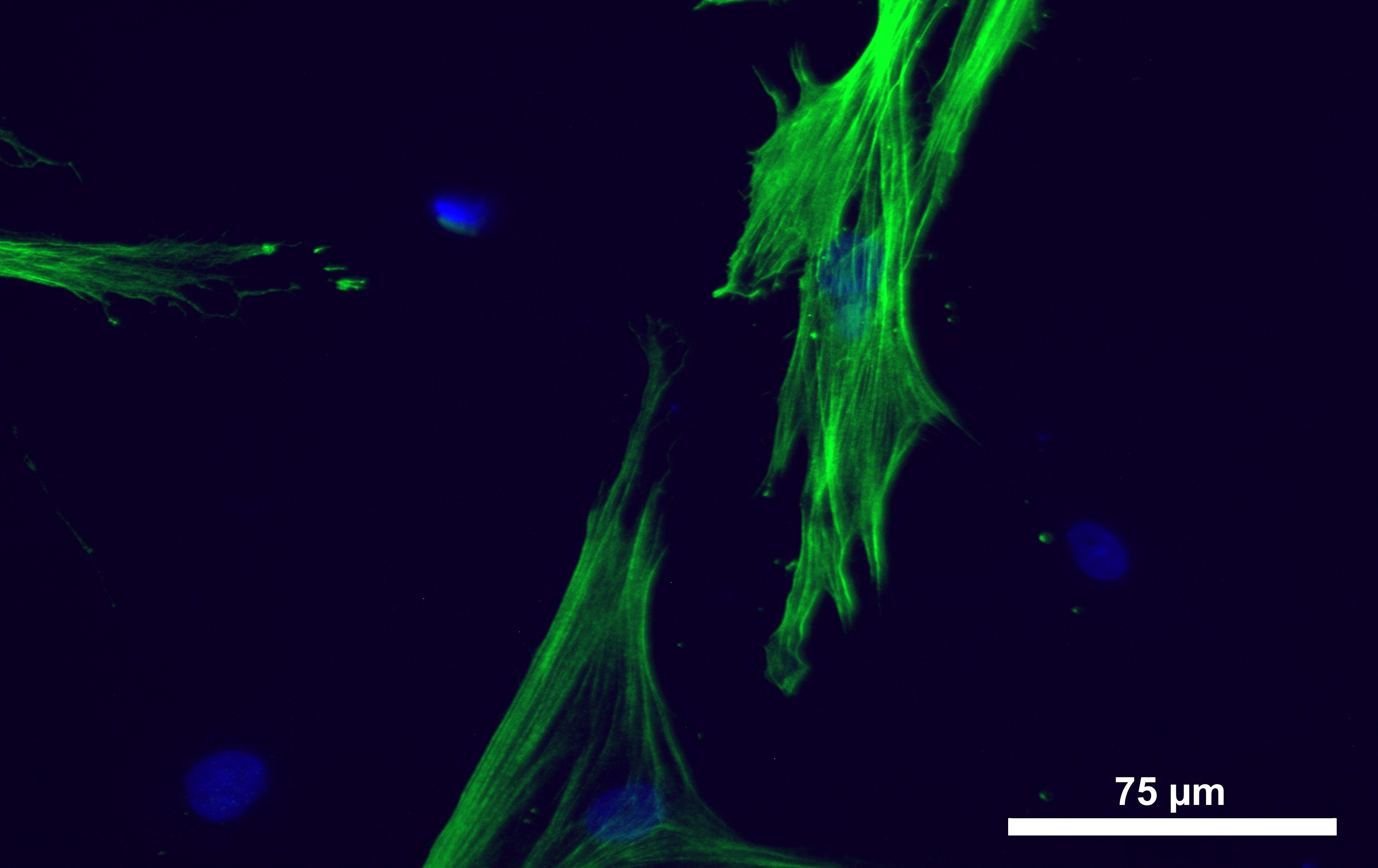 Electron micrograph of cultured corneal cells stained green.