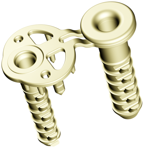 The components of the implant, gold-coloured and made of biocompatible plastic