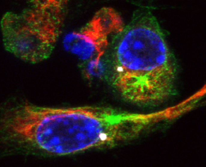 Neu entdeckte Wirkstoffe aktivieren das Inflammasom in Makrophagen