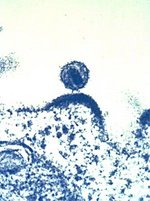 Die elektronenmikroskopische Aufnahme zeigt ein von der Zelloberfläche einer Maussarkomzelle knospendes RNA-Tumorvirus sowie ein bereits freigesetztes Virus (Quelle: Zell- und Tumorbiologie, DKFZ)