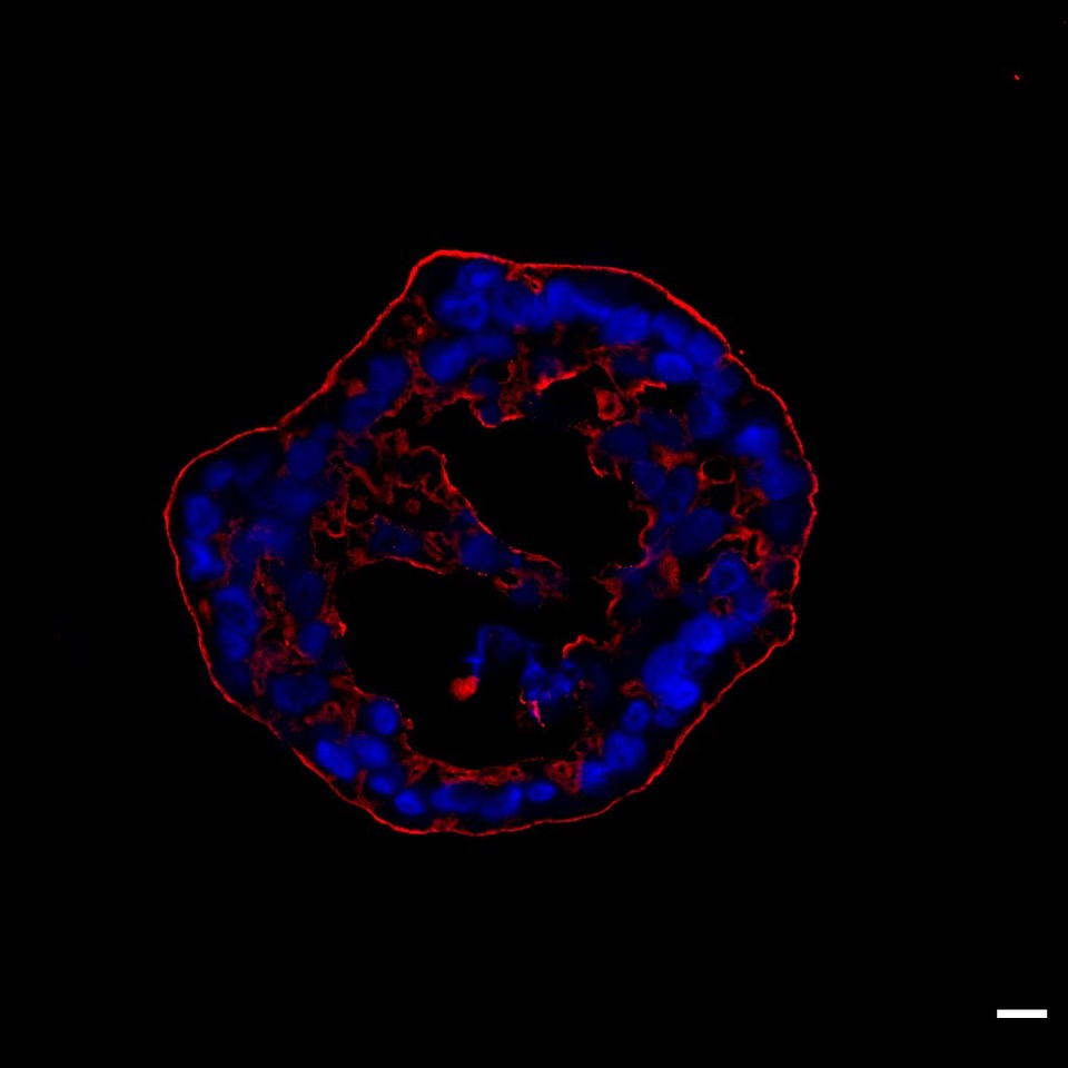 The image shows a cell on a black background. Parts of the cell fluoresce red (mainly along the edges) and blue (roughly circular structures inside the cell).