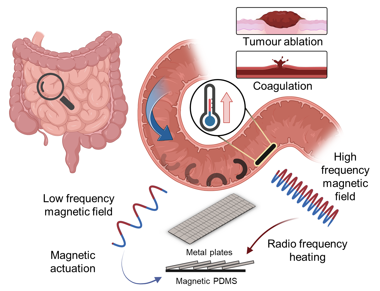 You can see a drawing of a large and small intestine and next to it an enlarged view of a small intestine with a miniature robot inside as well as various illustrations of the robot and possible areas of application.