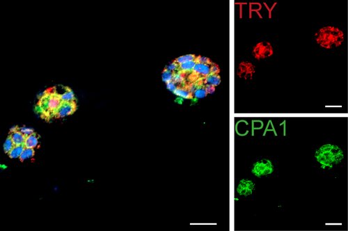 Comparison of differently stained organoids (coloured, red and green).