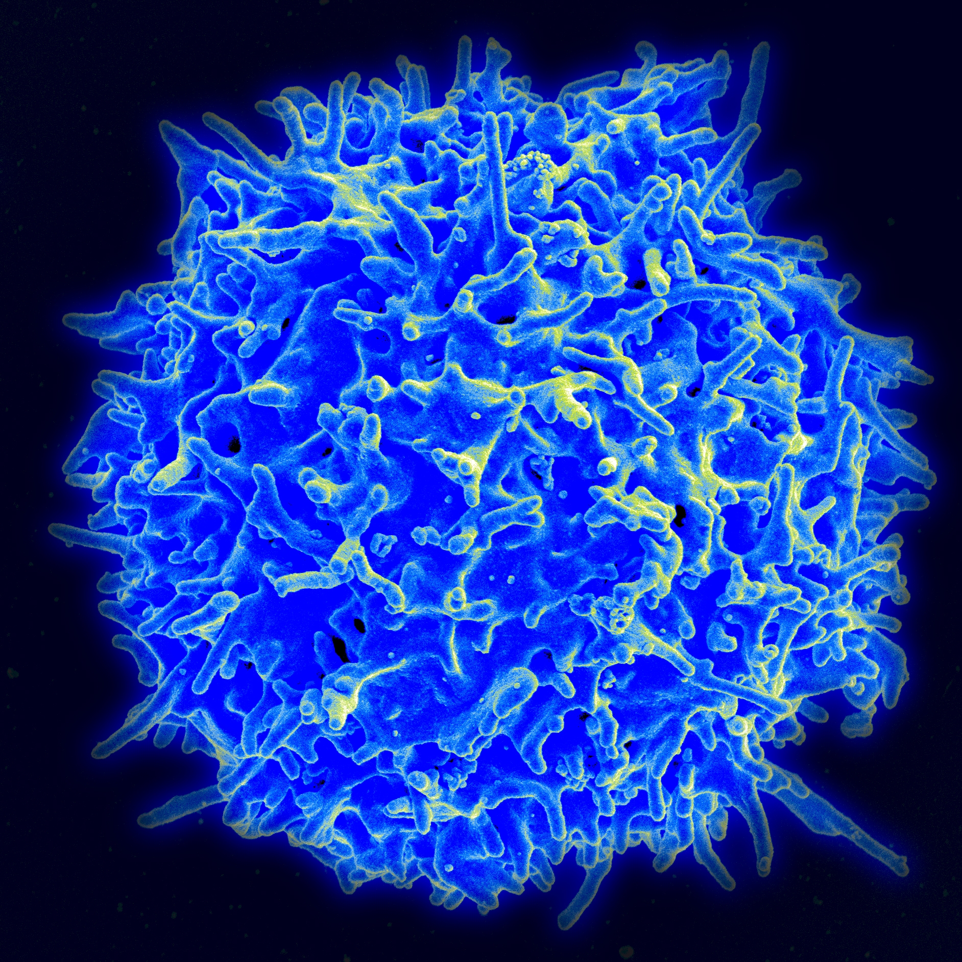 Enlarged image of a human T lymphocyte