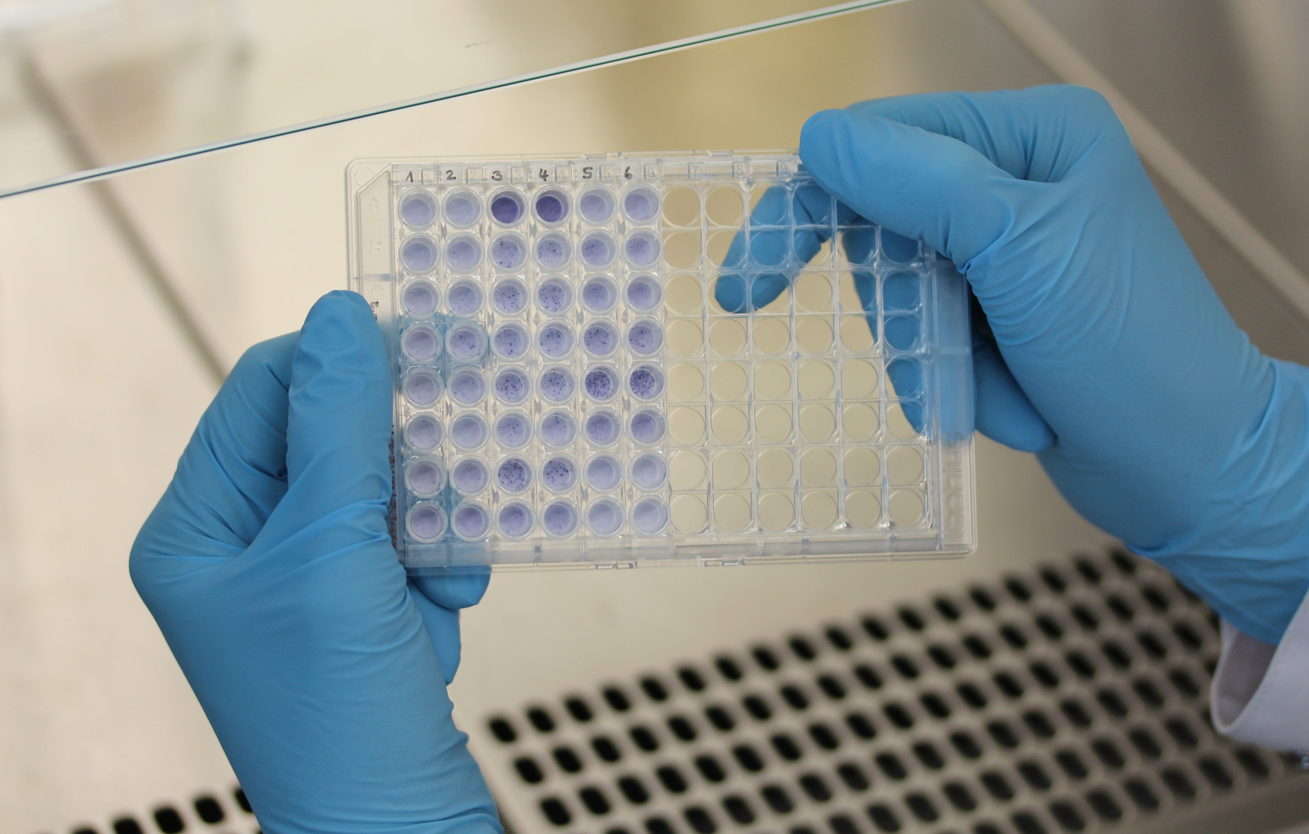 The photo shows an immunoassay with numerous blue spots of different intensities, which represent the strength of the immune responses.