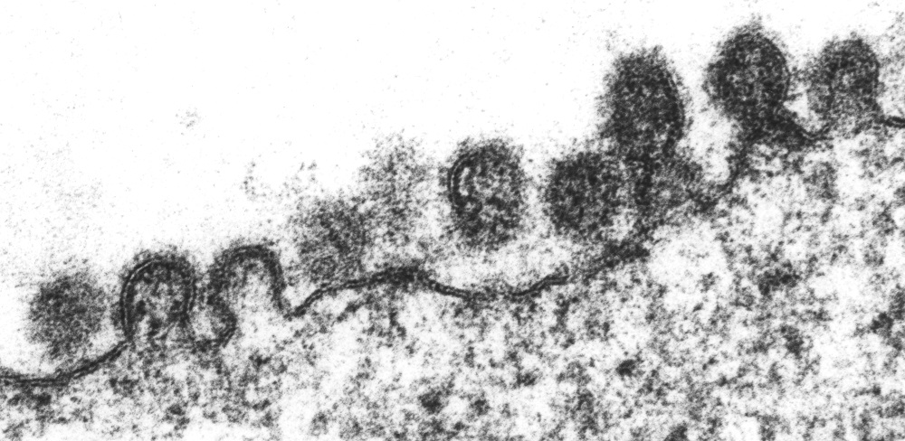Elektronenmikroskopische Schwarz-Weiß-Aufnahme der quer geschnittenen Oberfläche einer Wirtszelle. Zu sehen sind mehrere neu hergestellte Viren, die in unterschiedlichen Stadien soeben dabei sind, sich von der Wirtszelle abzuschnüren.