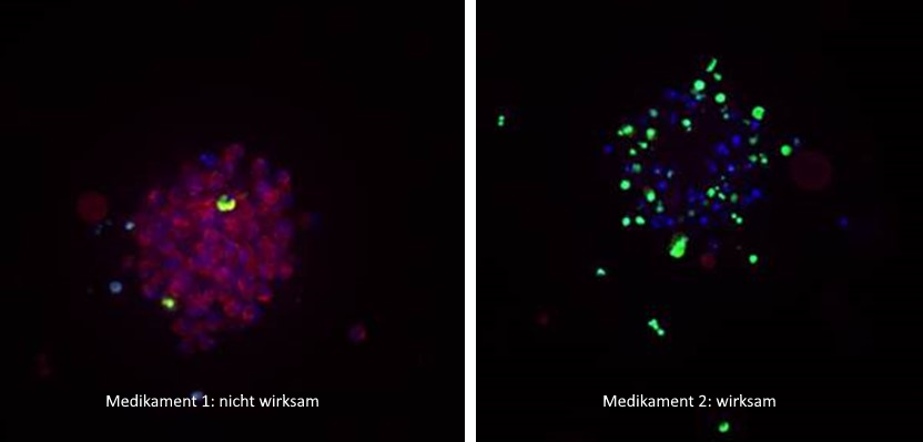 n the image on the left, the cells of the miniature tumors glow red and blue, in the image on the right they glow green and blue.