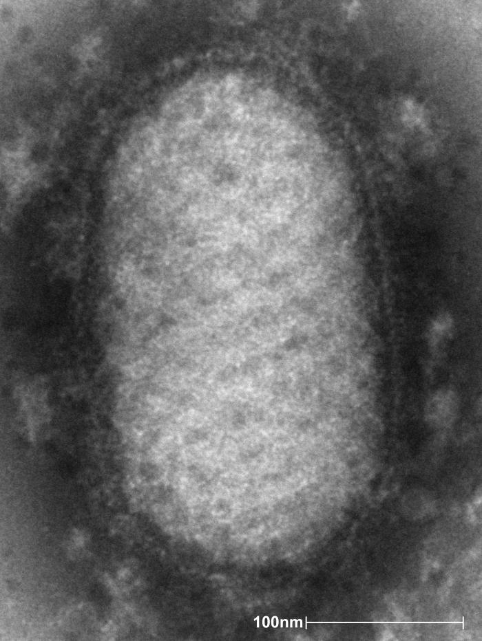Electron microscope image of the Orf virus.