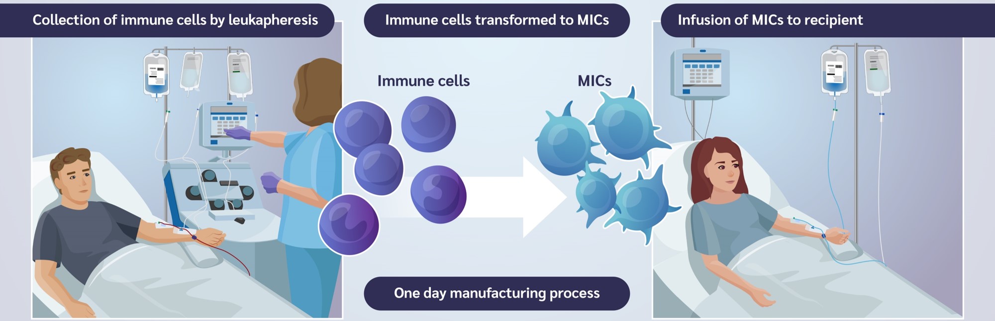 Schematic of the treatment process. The left picture shows a person lying in bed connected to a leukapheresis machine. In the middle, the transformation of the immune cells obtained into MICs is depicted, which in the right picture are administered to the person lying in bed.