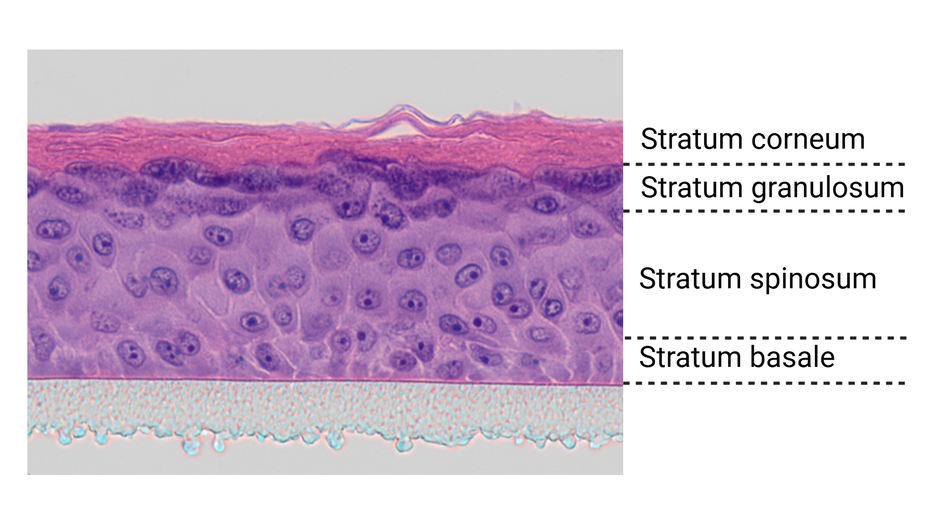 This is a microscopic image of a cross-section of the reporter skin, in which the different skin layers can be clearly recognised.