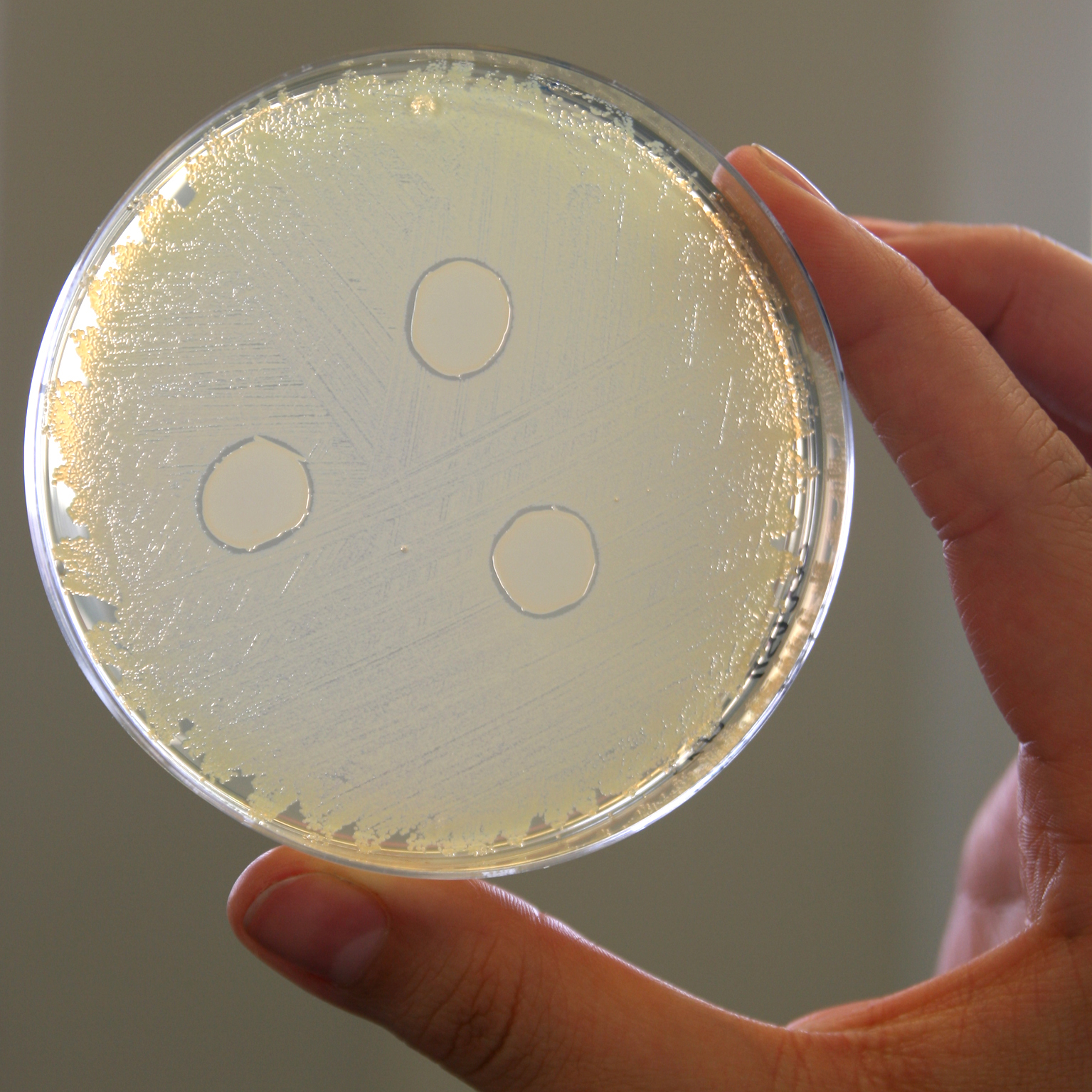 In a Petri dish with Staphylococcus aureus cultures, inhibitory zones can be seen around Staphylococcus lugdunensis colonies can be seen.