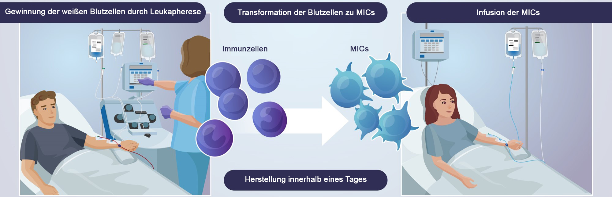 Zeichnerische Darstellung des Behandlungsprozesses. Auf dem linken Bild ist eine im Bett liegende Person zu sehen, die an die Leukapherese angeschlossen ist. In der Mitte ist die Verwandlung der gewonnen Immunzellen zu MICs dargestellt, die im rechten Bild einer Person transfundiert werden.