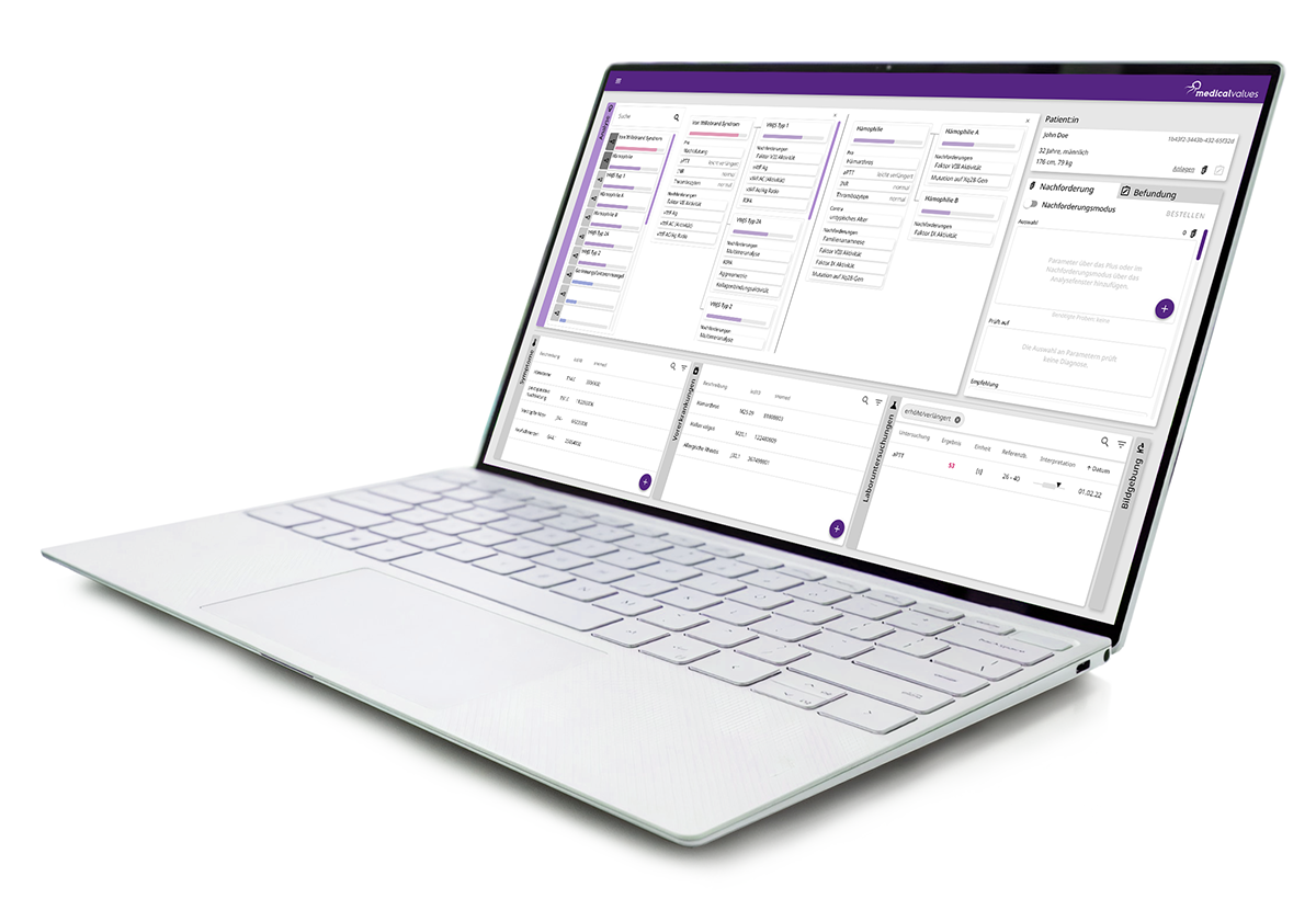 Laptop screen displaying software results; shown in white and partly purple.