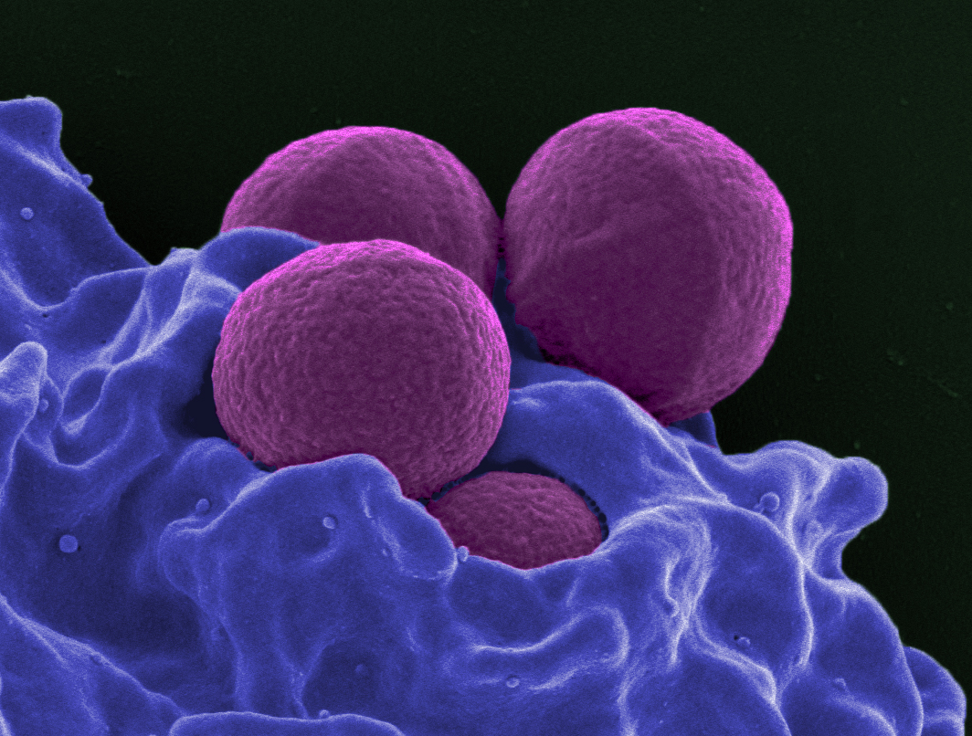 Electron microscopic image of pink stained Staphylococcus aureus bacteria on a red stained cell surface.