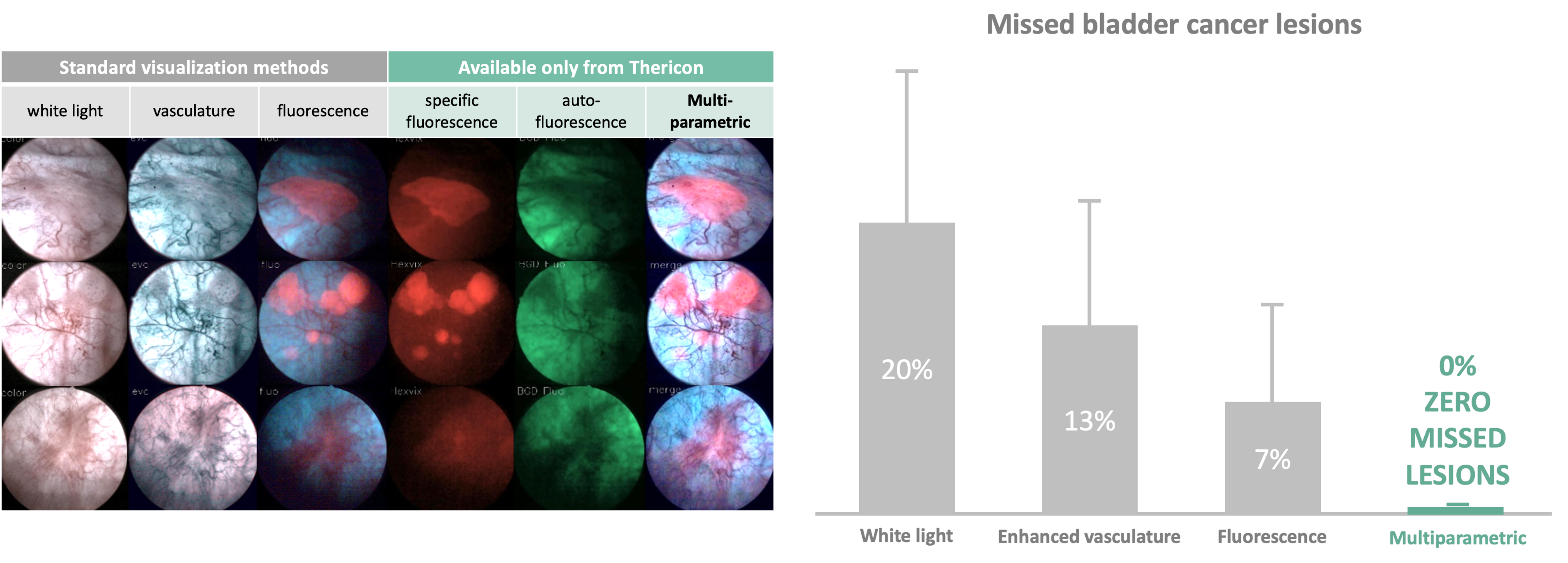 Tabellarische Anordnung endoskopischer Bilder verschiedener Gewebeläsionen dargestellt mit (von links nach rechts) Weißlicht, Narrow Band Imaging, photodynamischer Diagnostik, spezifischer Fluoreszenz, Autofluoreszenz und der rMSI-Technologie. Balkendiagramm des prozentualen Anteils der verfehlten Tumorerkennung im Weißlicht (20%), mit Narrow Band Imaging (13%), photodynamischer Diagnostik (7%) und rMSI-Technologie (0%).