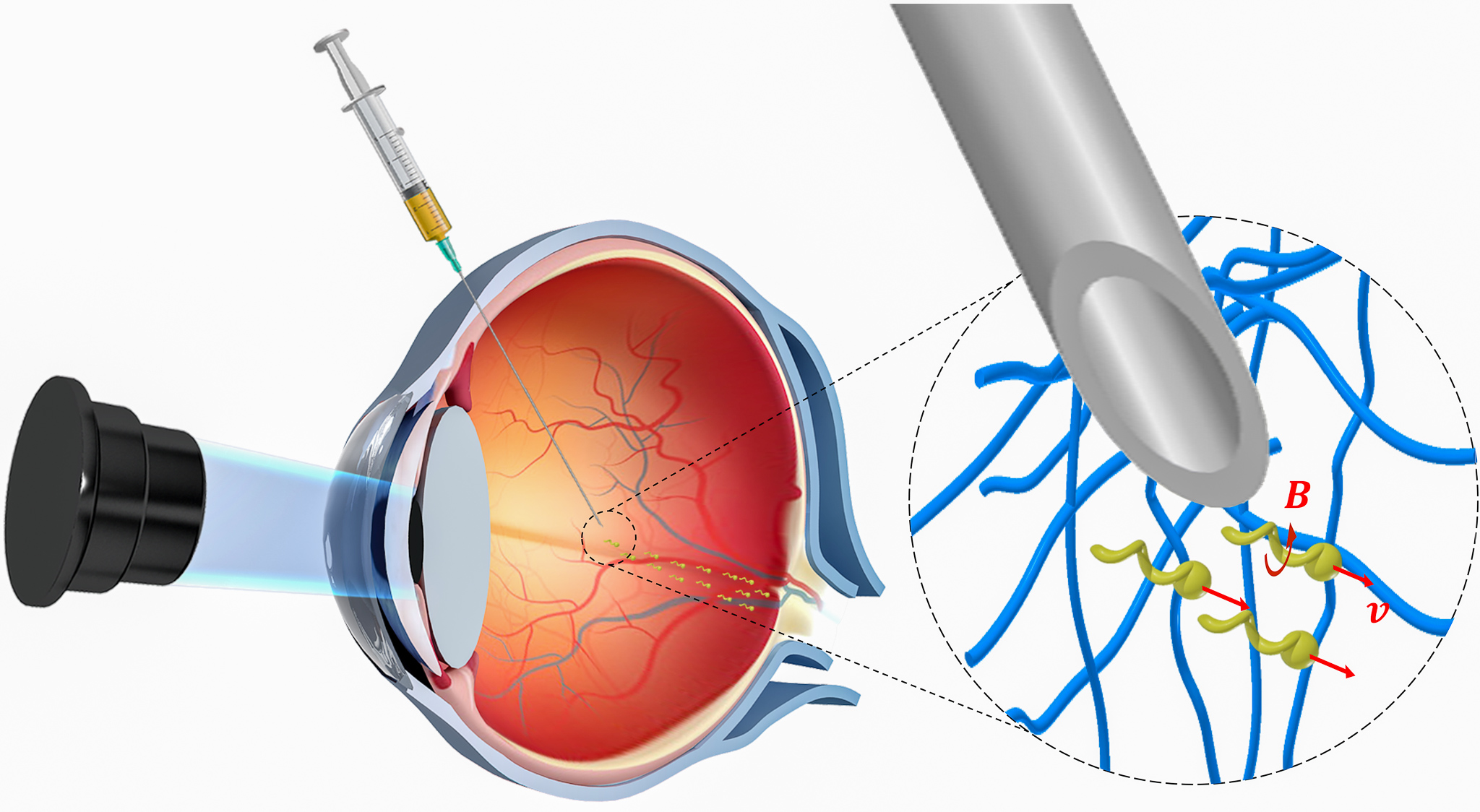 Figure showing a schematic cut through an eye ball into which the propellers are injected. An amplified version of the latter is shown in the protein mesh of the vitreous body on the right-hand side. 