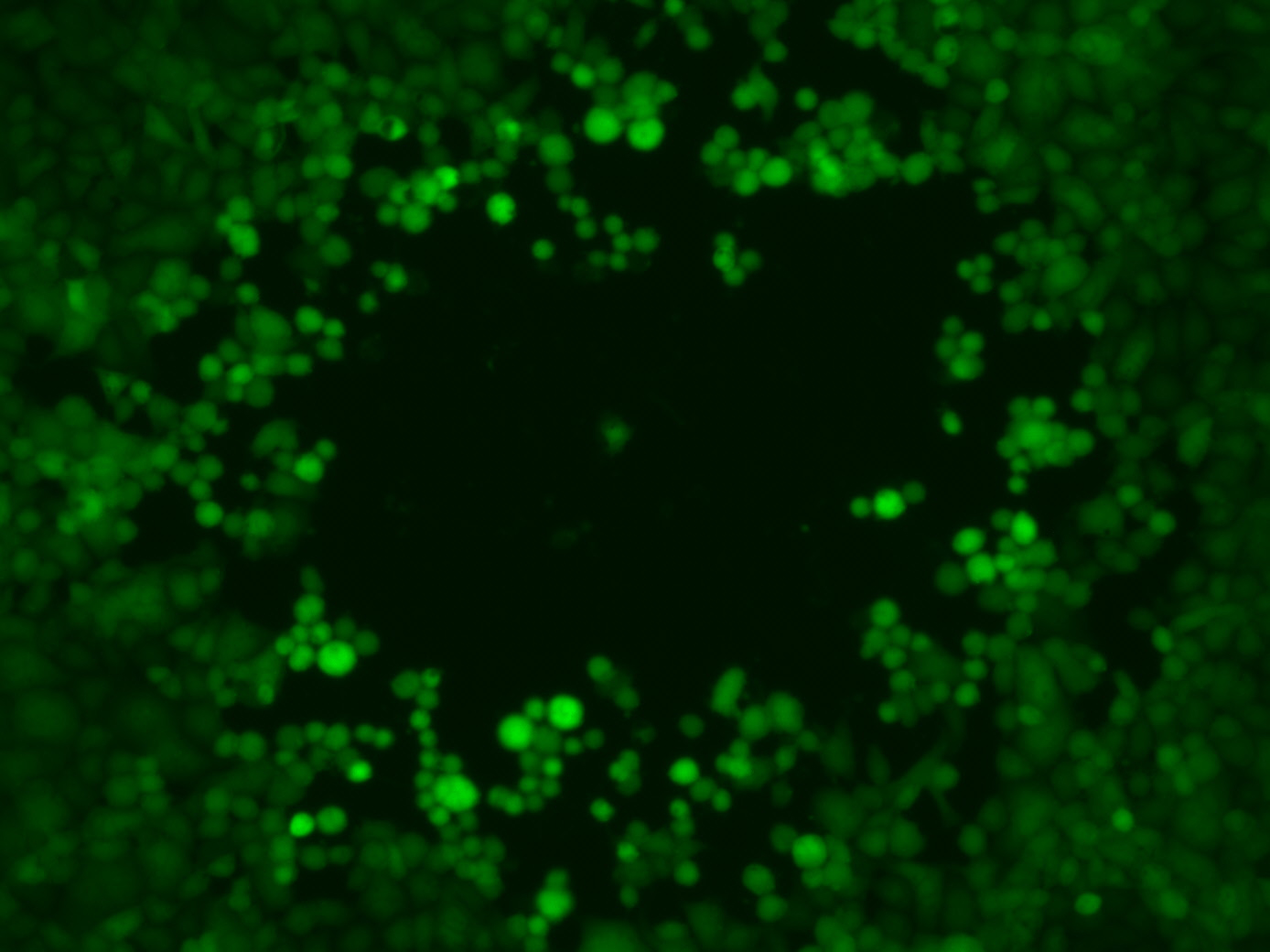 Mikroskopische Aufnahme der Plaquebildung durch HSV1-Viren (grün fluoreszierend).