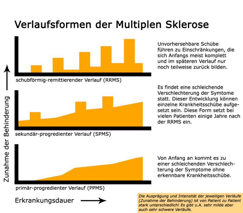 Krankheitsverlauf der Multiplen Sklerose.