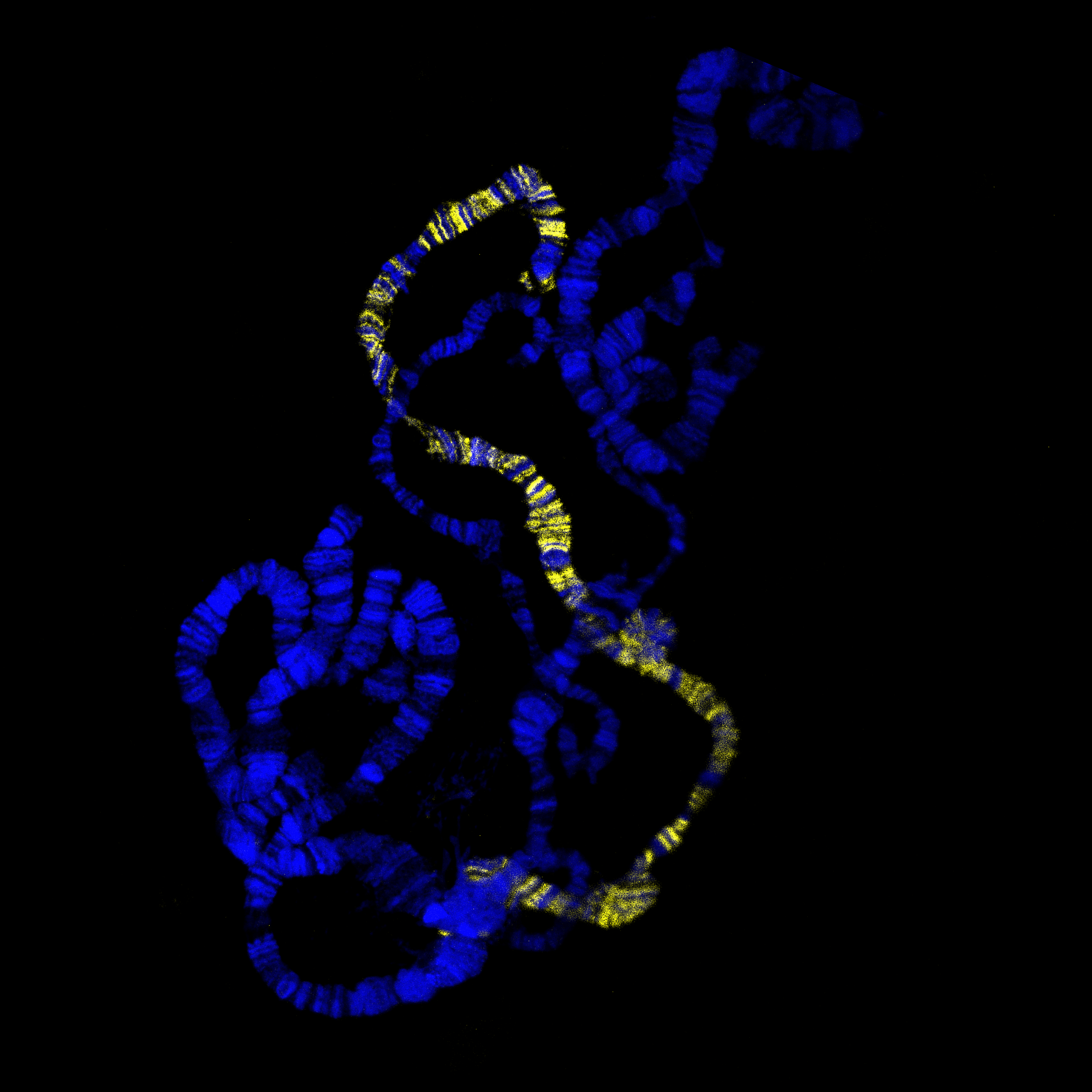 Against a black background, a yellow glowing chromosome is visible between blue coloured chromosomes.