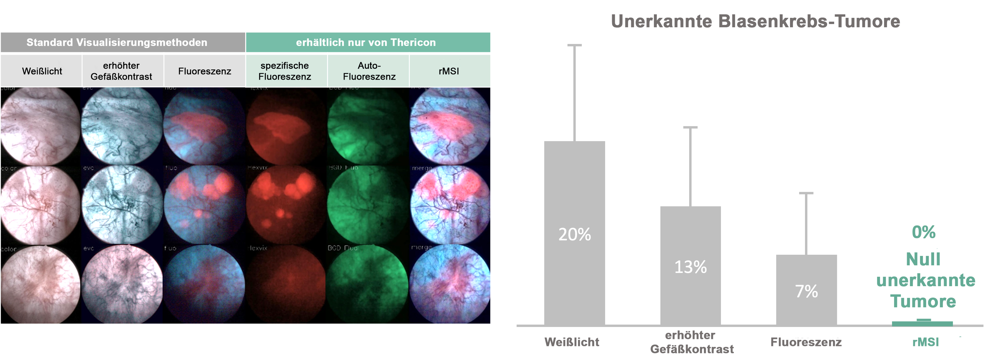 Tabellarische Anordnung endoskopischer Bilder verschiedener Gewebeläsionen dargestellt mit (von links nach rechts) Weißlicht, Narrow Band Imaging, photodynamischer Diagnostik, spezifischer Fluoreszenz, Autofluoreszenz und der rMSI-Technologie. Balkendiagramm des prozentualen Anteils der verfehlten Tumorerkennung im Weißlicht (20%), mit Narrow Band Imaging (13%), photodynamischer Diagnostik (7%) und rMSI-Technologie (0%).