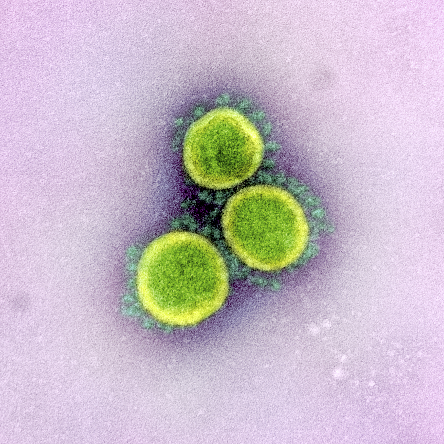 Coronavirus seen under an electron microscope
