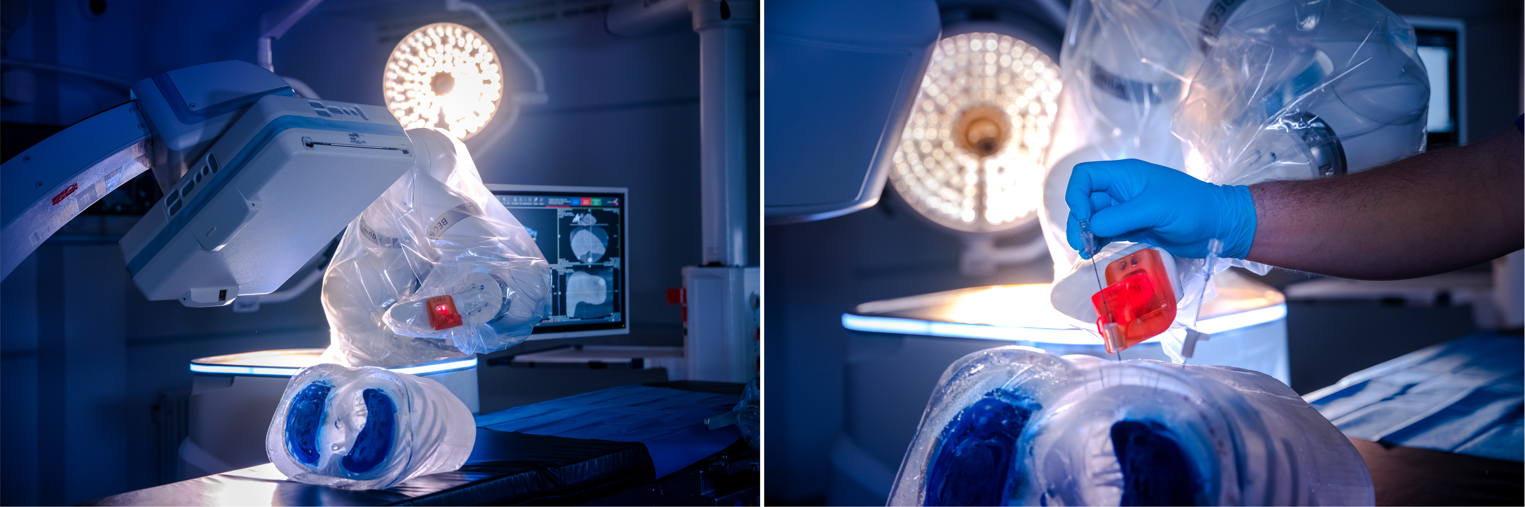 Links ist der Roboterarm in der Nähe eines auf dem Operationstisch liegenden künstlichen Torso zu sehen und darüber ein Teil des Computertomografen. Rechts die Hand von guidoo und zwei im Torso platzierte Führungshülsen, durch die eine Hand im blauen Handschuh eine Biopsienadel sticht.