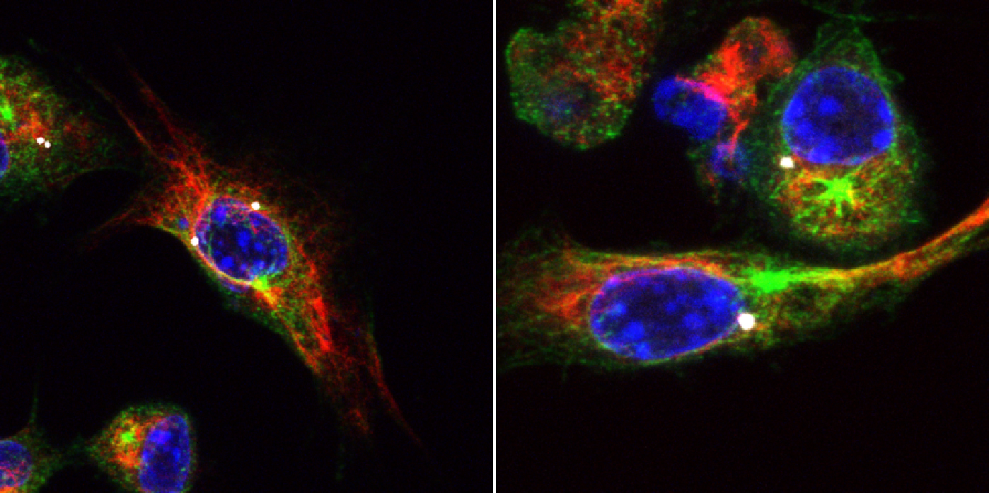 Fluorescence microscope image of stained macrophages. Activated inflammasomes are visible as small white dots, next to large blue cell nuclei and red and green cell structures.