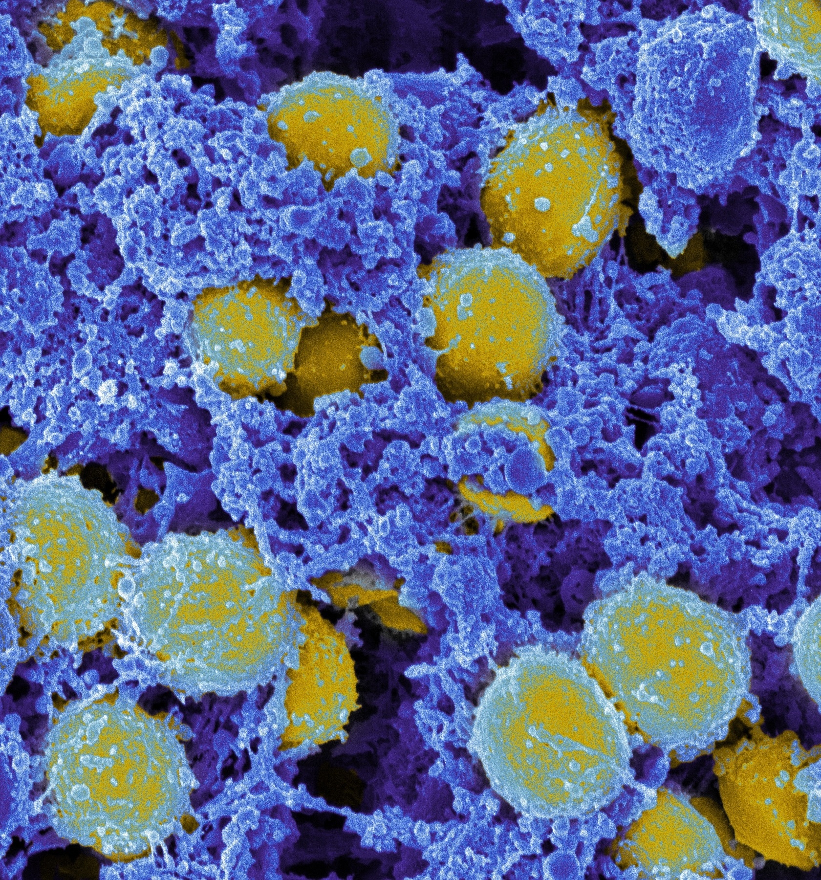 Yellow, spherical bacteria can be seen in a blue-coloured tissue.