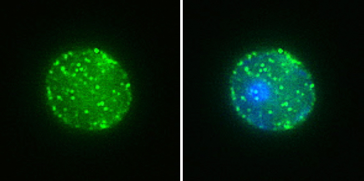 Images of haematopoietic stem cells. The stem cell samples are characterised by a larger than normal level of Wnt5a protein (shown in green). The second image shows counterstained nucleic (blue).