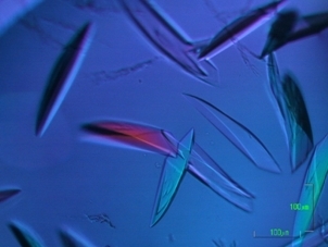 Zu sehen sind rote und blaue spindelartige Gebilde gegen einen blauen Hintergrund.