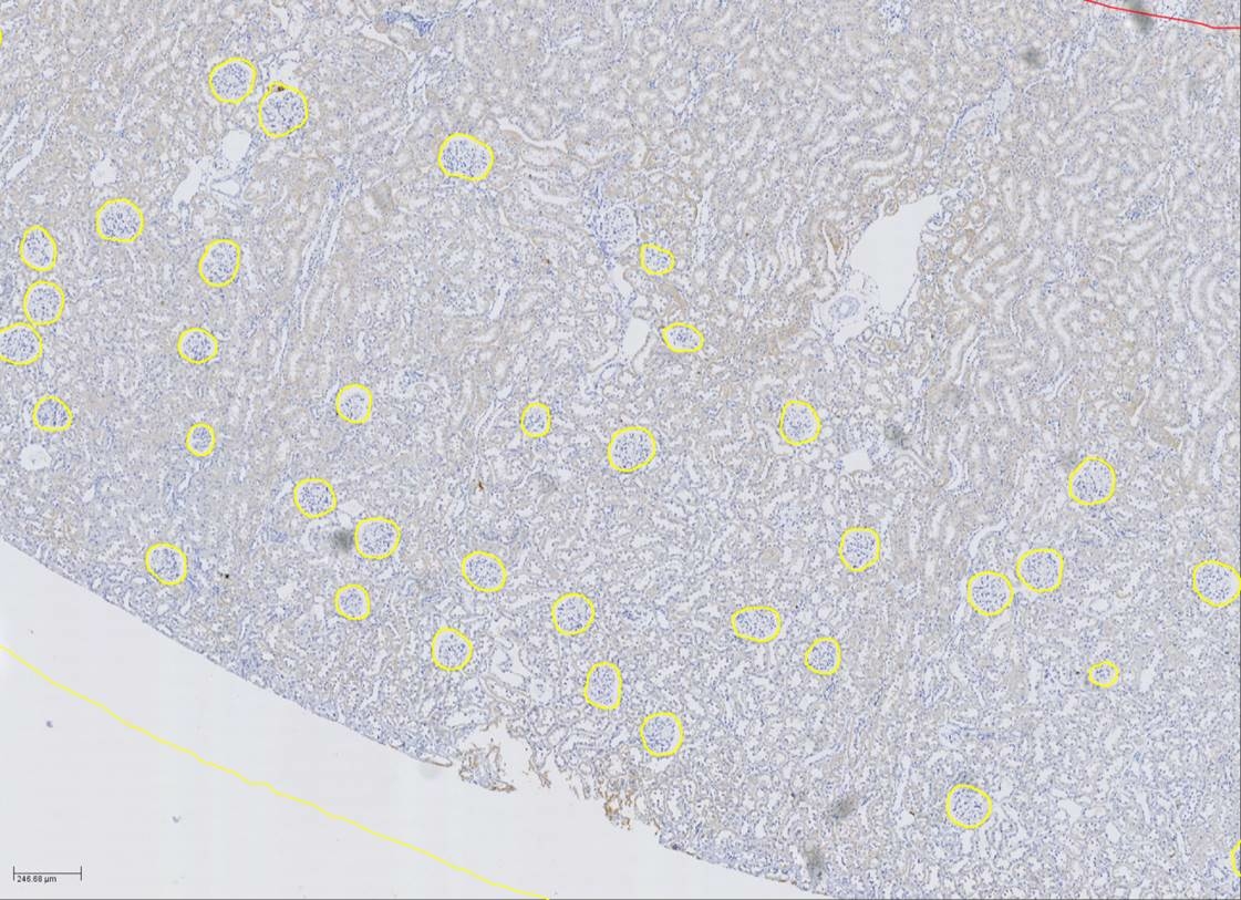 Microscope image of a kidney section, marked with yellow circles.