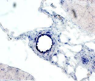 Das Bild zeigt einen Schnitt durch bläulich gefärbtes Gewebe im Mikroskop. Im Zentrum der Aufnahme ist ein Hohlraum, der eine Arterie im Querschnitt darstellt. Der den Hohlraum umschließende Bereich ist stärker blau eingefärbt, als die umliegenden Bereich