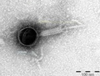 Elektronenmikroskopische Aufnahme eines Bakteriophagen.