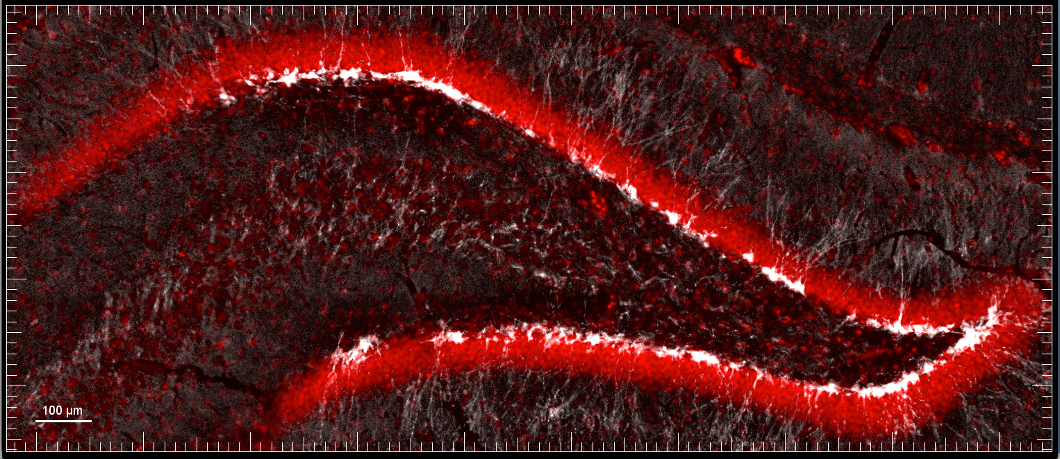 The photo shows the dentate gyrus of a rat (part of the hippocampus). The nuclei of the nerve cells that run like a ribbon from the left-hand to the right-hand side of the photo, are stained red; immature, newly formed nerve cells are white.