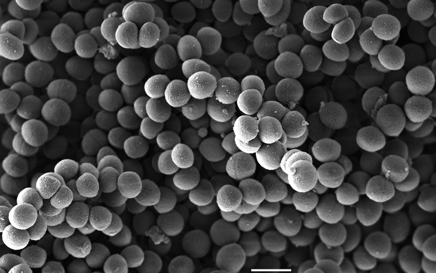 Electron microscope image of Staphylococcus aureus bacteria which have become resistant to many antibiotics.