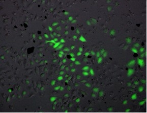 The photo shows green cells against a dark grey background.