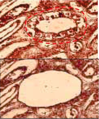 Auswahl eines mikroskopischen Objekts aus der Nierenrinde. 2 Bilder sind geuzeigt.