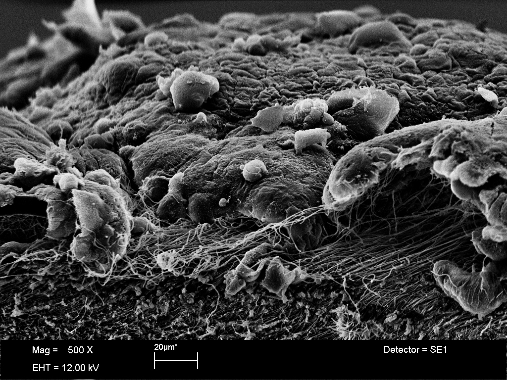 Scanning microscope image showing the growth of cells on gelatine fibres