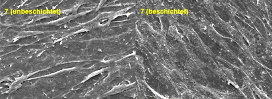 Rasterelektronenmikroskopie. Im Bild rechts: deutlich strukturierte Zelloberfläche durch osteointegrale Oberflächenbeschichtung des Implantatwerkstoffs. Keine spindelige Morphologie der Zellen.