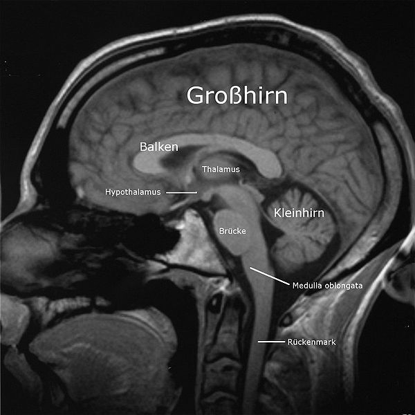 Zu sehen ist die schwarzweisse MRT-Aufnahme eines menschlichen Gehirns mit seinen unter der Grosshirnrinde liegenden Arealen von der Seite.