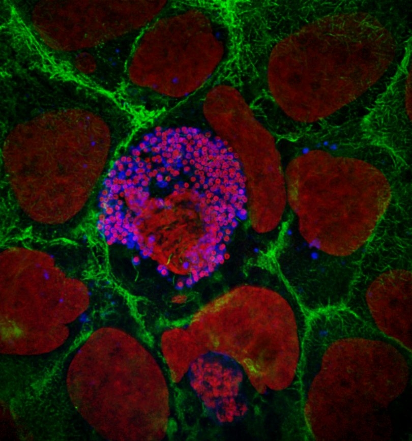 Fluoreszenzmikroskopisches Bild von mehreren Hepatozyten. Eine davon beinhaltet deutlich Merozoiten, welches sich durch die starke rote und blaue Fluoreszenz äußert.