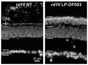 Der elektronenmikroskopische Querschnitt zeigt links unbehandelte und rechts behandelte Maus-Netzhaut. Nur rechts sind kräftige helle Leuchtpunke in der Photorezeptorschicht zu sehen, die überlebende Photorezeptoren anzeigen.