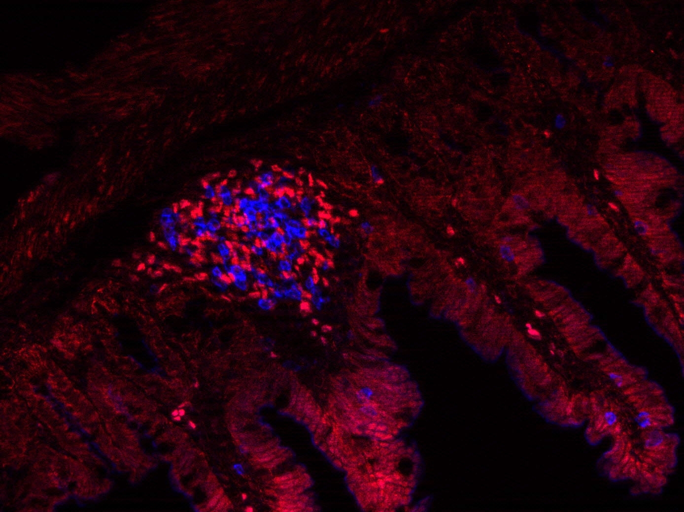 Querschnitt durch die Darmwand (matt rot) im Fluoreszenzmikroskop, mit Darmfollikeln, in denen sich LTi-Zellen (hellrot) und B-Lymphozyten befinden. Zu sehen sind zottelartige matt rot leuchtende Strukturen, an deren Basis jeweils heller rot leuchtende un