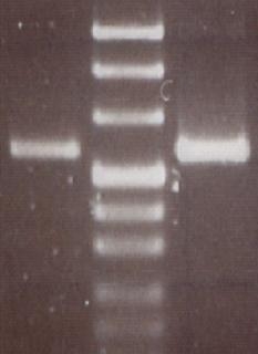 Polymerase chain reaction (PCR) and gel electrophoresis are used to identify specific genes of the bacteria. (Photo: Dr. Friederike von Loewenich)