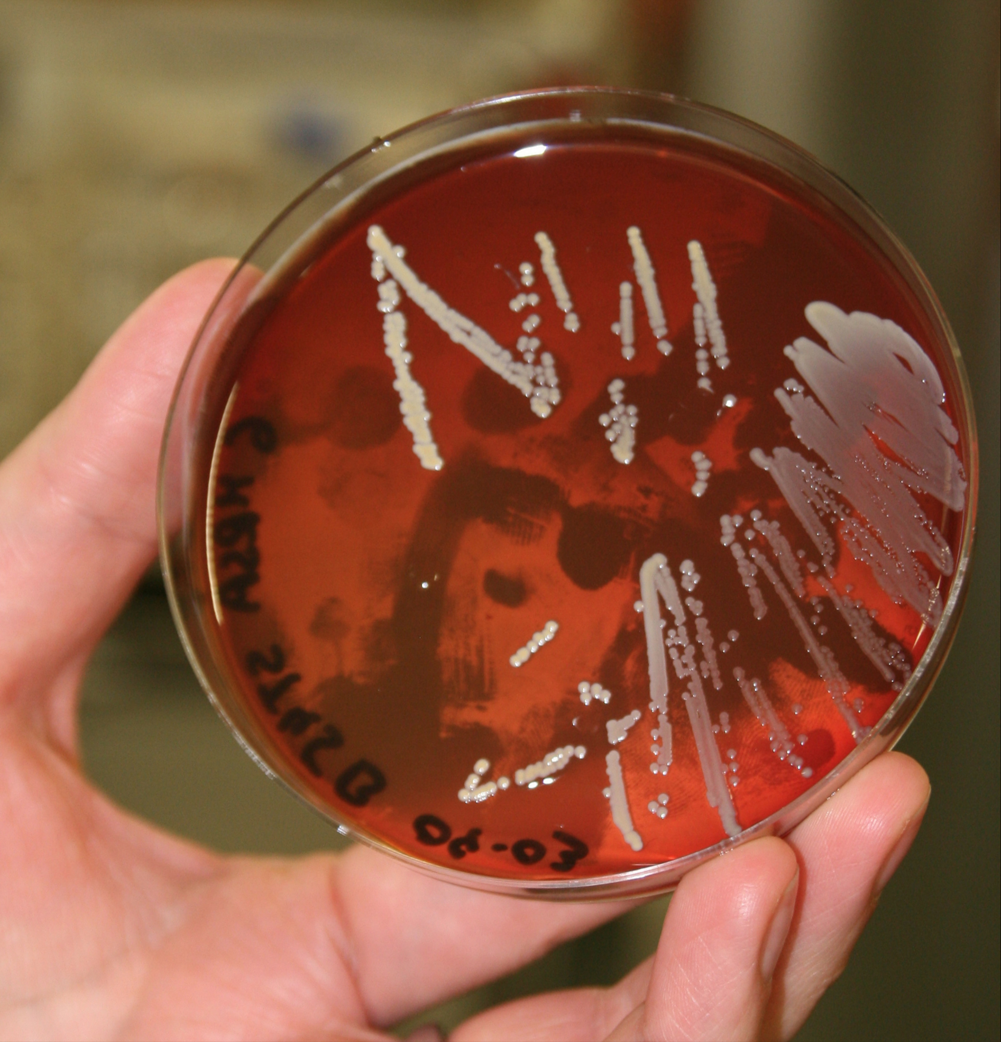 The photo shows white colonies growing in a zickzack pattern on a red agar plate