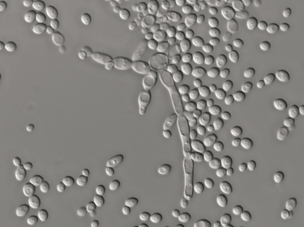B/w microscope image of Candida cells.