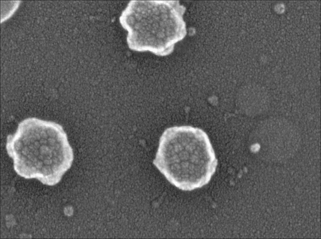 Elektronenmikroskopische Aufnahme von Adenoviren, unbehüllten rundlichen Werkzeugen der Vektorologie.
