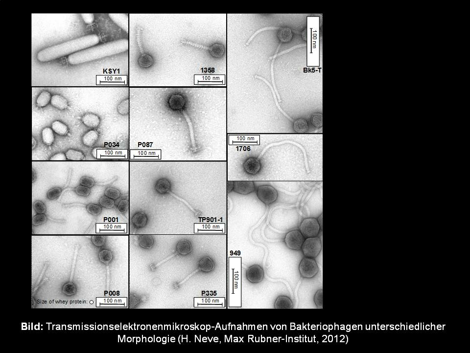 Zu sehen sind Transmissionselektronenmikroskop-Aufnahmen von Bakteriophagen unterschiedlicher Morphologie.