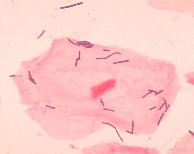 Lactic acid bacteria under the microscope. The photo shows black rods moving around on pink tissue.